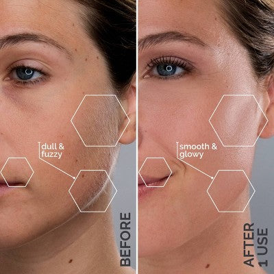 Spa Sciences SIMA Deluxe Sonic Dermaplaning Tool for Exfoliation & Peach Fuzz Removal - Imperfect Box
