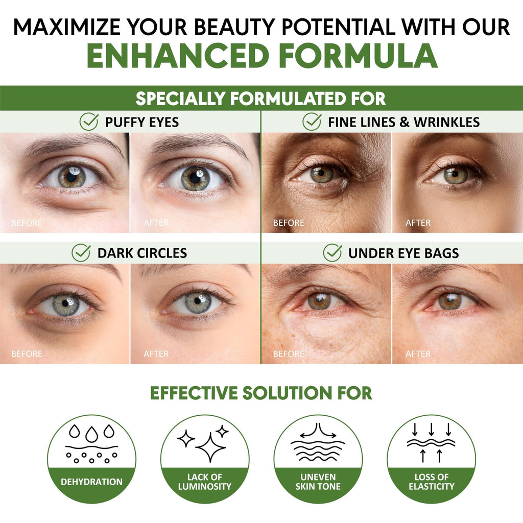 Green Tea Under Eye Patches for Wrinkles and Eye Bags 30 Pairs Eye Masks for